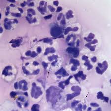 Image result for Rhodococcus equi