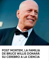 El CEREBRO DE BRUCE WILLIS SERÁ DONADO A LA CIENCIA La esposa de Bruce  Willis informó que, cuando el actor fallezca, su cerebro será donado a la  ciencia para contribuir a la