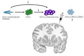 Sources Of Stem Cells For Replacement Therapy For Huntington S Disease Download Scientific Diagram