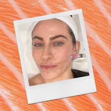 I Got a Salmon Sperm Facial—And I'd Do It Again