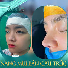 THẨM MỸ VIỆN AONE