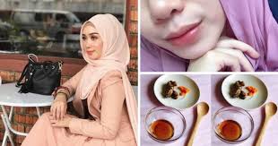Maybe you would like to learn more about one of these? Guna Kunyit Dan Madu Jika Mahu Bibir Cantik Dan Tidak Merekah