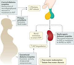 Diabetes insipidus occurs when your body can't properly balance the body's fluid levels. Diabetes Insipidus Nature Reviews Disease Primers