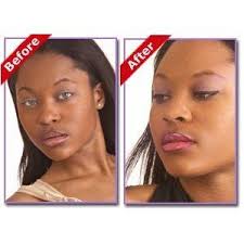 Before And After Black And White Bleaching Cream Reviews Pin On Beyonce Skin Bleaching Secret