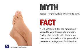 16 Foot Fungus Ideas Toenail Fungus Foot Fungus Athletes Foot
