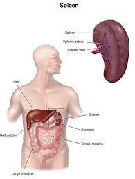 Image result for Splenic Abscess