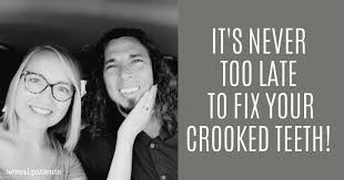 Negative consequences of crooked teeth. 3 Cosmetic Dentistry Procedures That Fix Crooked Teeth Without Braces