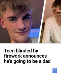 Fireworks tragedy teen shares magical milestone in bittersweet post after  losing eye