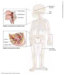 What part of the human body ages fastest? Rhabdomyosarcoma Childhood Medical Illustrations Cancer Net