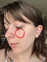 How to get rid of dark spots