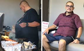 When will i know i am cured of cancer? It Looked Like A Beer Belly It Turned Out He Had A 77 Pound Tumor The New York Times