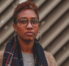 April Mitchell Encourages Others with Vitiligo to Talk about Their Spots