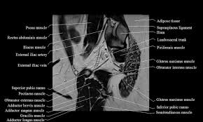 Learn the pelvic region of the trunk includes the bony pelvis, the pelvic cavity (the space enclosed by the in terms of comparative anatomy the human scapula. Mri Female Pelvis Anatomy Free Mri Sagittal Cross Sectional Anatomy Of Female Pelvis