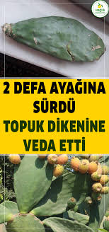 Topuk Dikeni Rahatsizligina Karsi Denenmis En Dogal Yontem Health Natural Health Remedies Natural Solutions