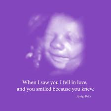 Pin On Baby Ultrasound Art