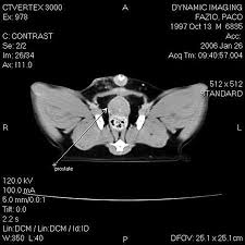 Up until recently, euthanasia was commonly recommended as the most humane approach, as dogs diagnosed with bladder cancer had a very small survival rate. Diagnosis Treatment Of Transitional Cell Carcinoma Tcc In Dogs