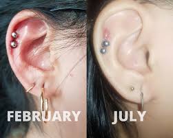 How can i reopen my cartilage piercing? Help Is My Helix Piercing Migrating Piercingadvice