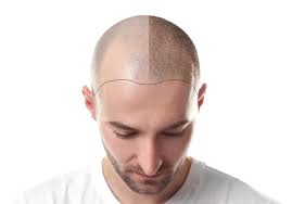 It features a proprietary blend of powerful drugs that helps restore hair quality, including thickness, volume, and more. 3 Hair Loss Products That Work 2021 Hair Loss Geeks