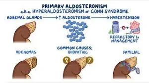 Image result for Hyperaldosteronism