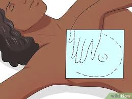 Get information on breast cancer (breast carcinoma) awareness, signs, symptoms, stages, types, treatment, and what role does the brca gene test have in breast cancer? How To Know If You Have Breast Cancer With Pictures Wikihow