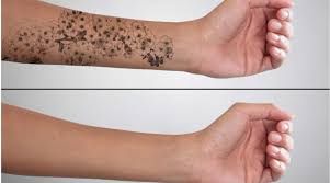 It was junk, sent by an unknown third party who is not using feedblitz to send their emails or manage their rss feeds. Tattoo Removal By Laser Cost In India Tattoo Removal By Laser In India Vaidam Com