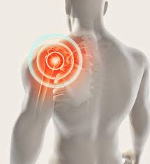 Image result for Shoulder Dislocation