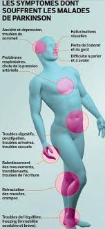Women develop the disease 2. Pourra T On Un Jour Guerir La Maladie De Parkinson