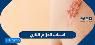وأعنف الزلازل وقعت في هذا الحزام أو بالقرب منه ، مثل :زلزال تشيلي العظيم أعنف الزلازل. Ø§Ø¹ØªÙ…Ø§Ø¯ ØªØ±ÙˆØ¬ ÙŠØ´Ø¬Ø¹ ÙŠØ¹Ø²Ø² ÙŠÙ†Ù…Ù‰ ÙŠØ·ÙˆØ± Ø£ÙˆØ±ÙˆØ´ Ø§Ø¹Ø±Ø§Ø¶ Ø§Ù„Ø­Ø²Ø§Ù… Ø§Ù„Ù†Ø§Ø±ÙŠ Ø§Ù„Ø¯Ø§Ø®Ù„ÙŠ Carerak Com