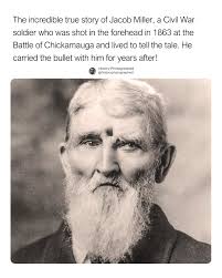 Civil War Soldier's Unbelievable Story: A Bullet in His Head for Decades