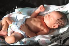 Ciri bayi kuning sudah sembuh 1. Ternyata Berjemur Tidak Efektif Atasi Bayi Kuning Simak 10 Fakta Tentang Bayi Kuning Yang Ibu Tidak Tahu Semua Halaman Nakita