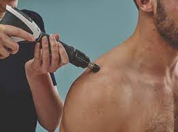 Elles sont transmises à travers la surface de la peau et diffusées indications des ondes acoustiques. Qu Est Ce Que La Therapie Par Ondes De Choc Et Comment Aide T Elle Le Patient Gymna