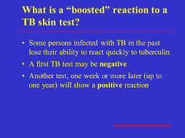 Find tb skin test providers near you. Tb Skin Testing Ppt Video Online Download