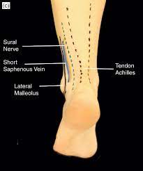 Pain deep in the buttocks, upper thighs, or back of the hips that starts gradually. Applied Basic Sciences Section 5 Postgraduate Orthopaedics