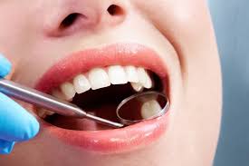If you have dental insurance, you're in luck. How Much Does A Tooth Filling Cost Orlando Fl S Keith Mahan Dds