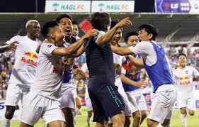 Hagl = humeral avulsion glenohumeral ligament the capsule of the shoulder joint, which contains the inferior glenohumeral ligament is ripped off the humerus with dislocation of the shoulder. How Thai Coach Transformed Hoang Anh Gia Lai Into A Top V League Team Vnexpress International