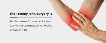 Tommy john surgery is not a slam dunk, so the best strategy is always to avoid surgery as despite popular belief, if you have tommy john surgery you are not guaranteed to return to your. Everything To Know About Tommy John Surgery Orthobethsda