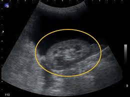 How much does an ultrasound machine cost? Ultrasound Scanning In Animals Ponsonby Vet And Herne Bay Vet Nz