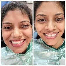 Evadent Multispeciality Dental Clinic in Andheri West,Mumbai