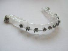 Diy guide on how to make fake braces that look real. 8 Diy Fake Braces Ideas Fake Braces Braces Diy Braces