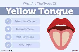 Image result for brown tongue symptoms