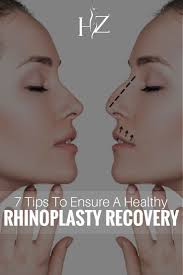While Performing The Rhinoplasty Is In The Hands Of Your Plastic Surgeon Making Sure You Recover Proper Rhinoplasty Recovery Rhinoplasty Nose Jobs Rhinoplasty