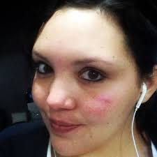 Fundraiser by Taylor Pappas : Taylor's Medical Fund