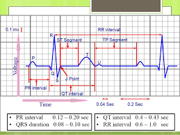 How To Read Ecg For Nurses Nursing Manthra