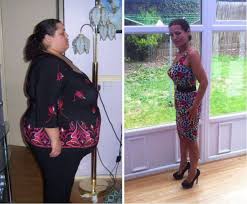 Pin On Obesity