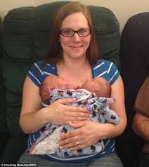 Twin siamese girls who are joined at the chest and share the same heart 'will have to remain together', doctors have said. Mother Of Conjoined Twins Who Share A Heart Finally Welcomes Them Home Daily Mail Online