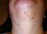 Normal Female Chin Hair