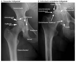 Orthopadische Chirurgie Und Sportmedizin Spital Oberengadin