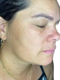 CENTRO UNIVERSITÁRIO DO VALE DO ARAGUAIA