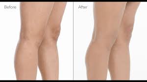 2 Steps To Cover Up Leg Veins With Makeup Leg Makeup Leg Veins Bb Cream Makeup