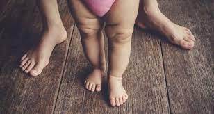 We did not find results for: Faktor Penyebab Kaki Bayi Menjadi Bengkok Popmama Com